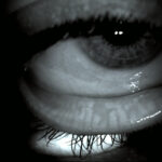 meibomian gland detaile photo